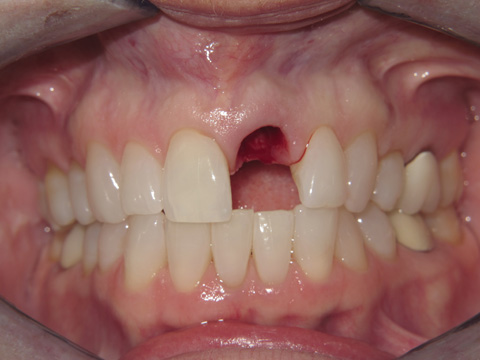 Smile Gallery - Dr. Michael Williamson