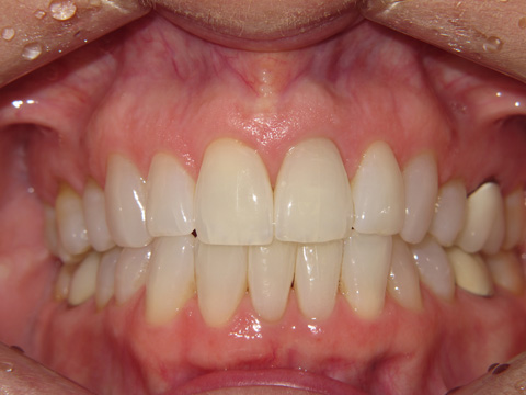 Smile Gallery - Dr. Michael Williamson