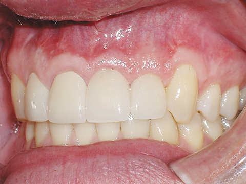 Smile Gallery - Dr. Michael Williamson