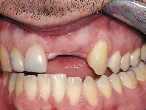 Smile Gallery - Dr. Michael Williamson