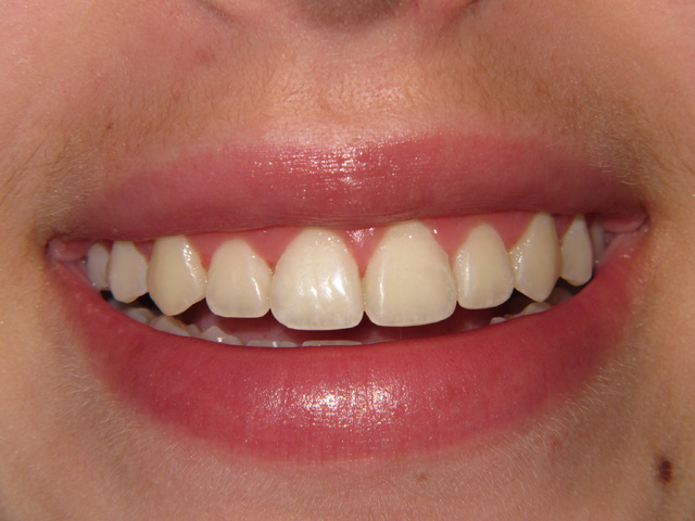 Smile Gallery - Dr. Michael Williamson