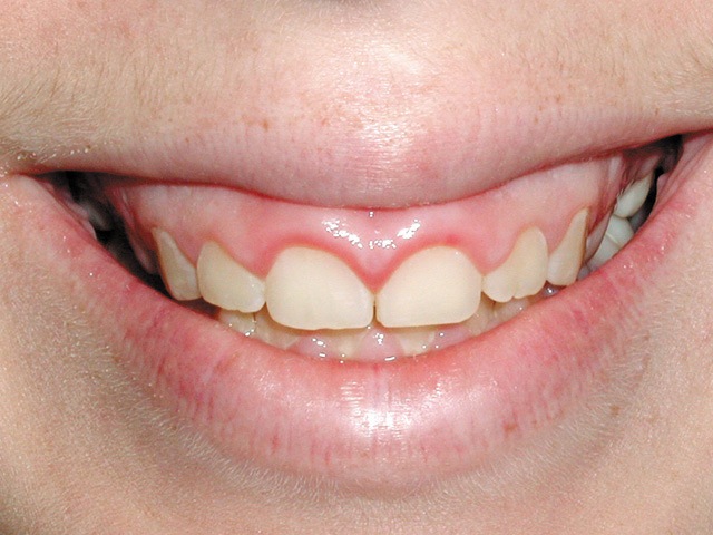 Smile Gallery - Dr. Michael Williamson