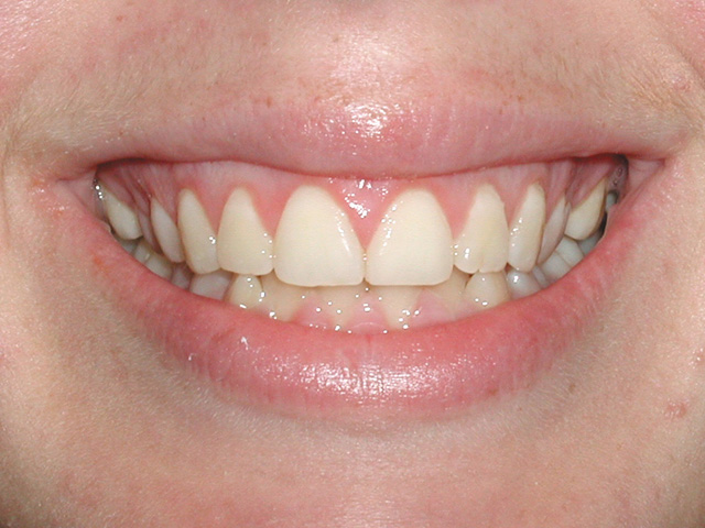 Smile Gallery - Dr. Michael Williamson