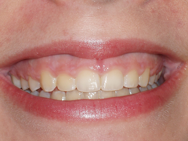 Smile Gallery - Dr. Michael Williamson