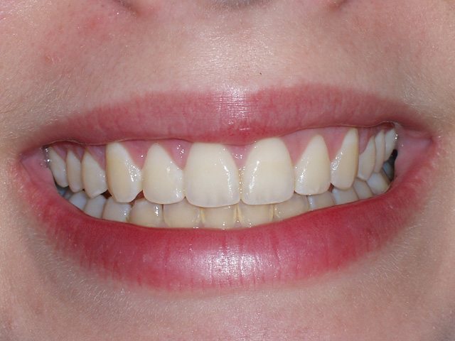 Smile Gallery - Dr. Michael Williamson