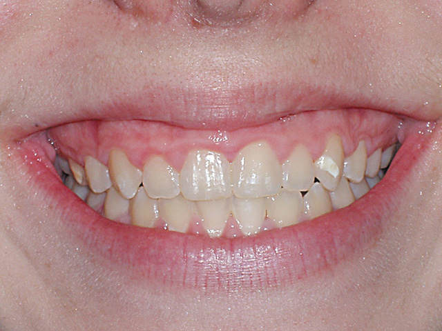 Smile Gallery - Dr. Michael Williamson