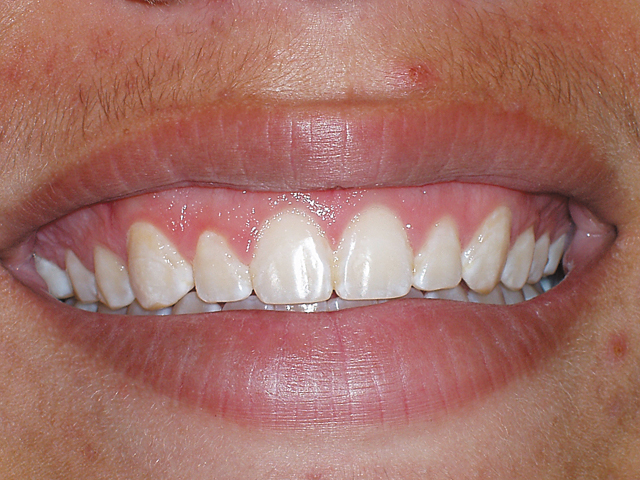 Smile Gallery - Dr. Michael Williamson