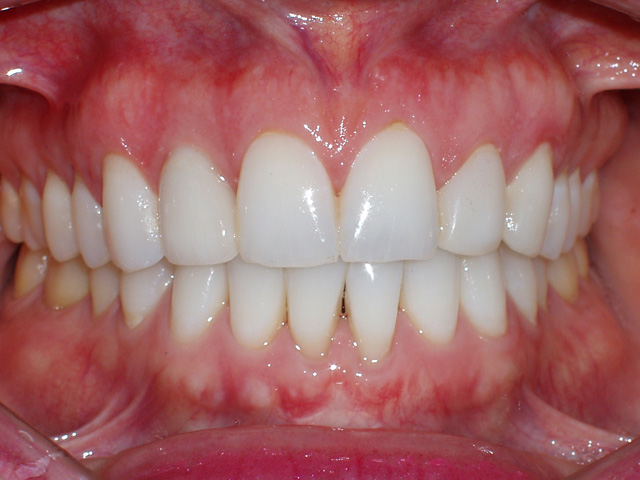 Smile Gallery - Dr. Michael Williamson