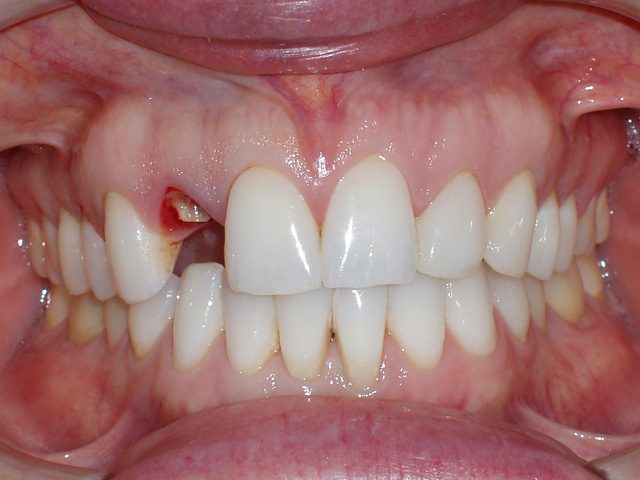 Smile Gallery - Dr. Michael Williamson