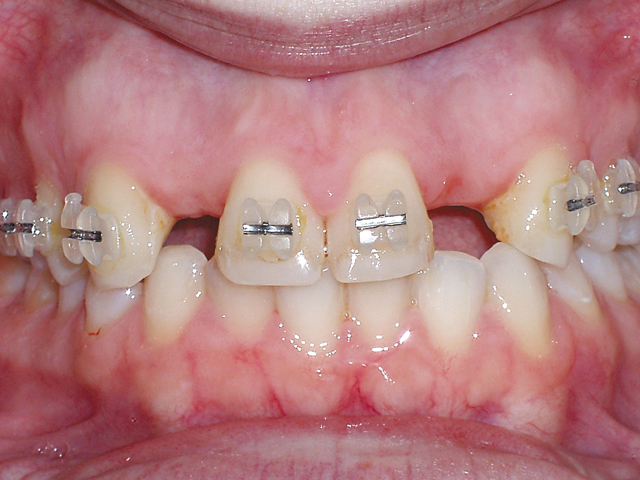 Smile Gallery - Dr. Michael Williamson