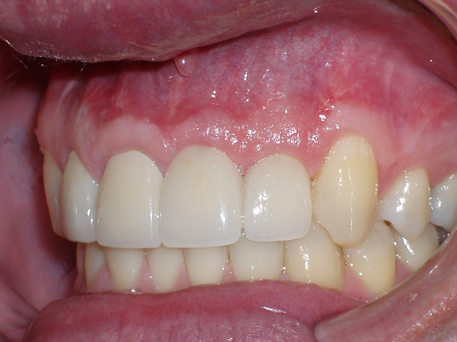 Smile Gallery - Dr. Michael Williamson