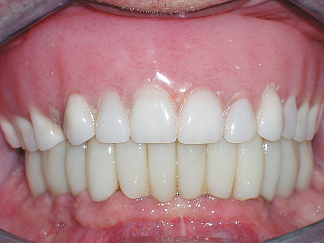 Smile Gallery - Dr. Michael Williamson