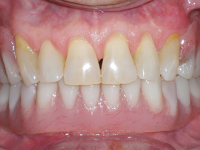 Smile Gallery - Dr. Michael Williamson