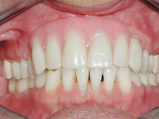 Smile Gallery - Dr. Michael Williamson