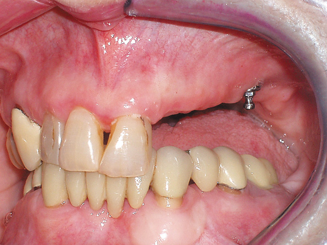 Smile Gallery - Dr. Michael Williamson