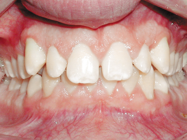 Smile Gallery - Dr. Michael Williamson