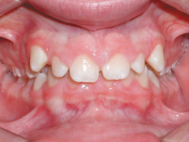 Smile Gallery - Dr. Michael Williamson