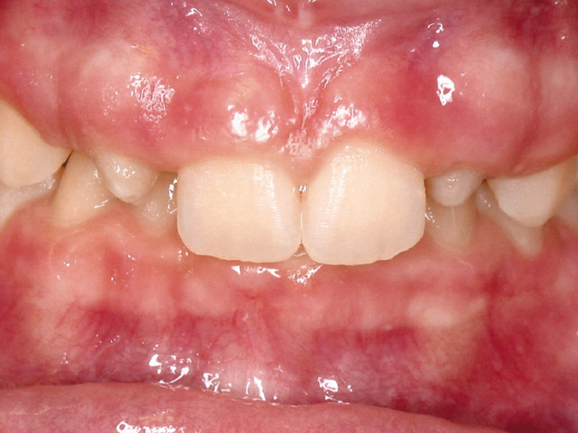 Smile Gallery - Dr. Michael Williamson