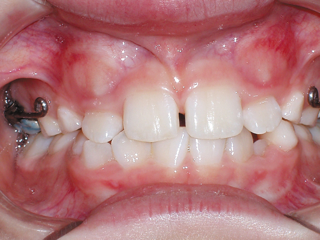 Smile Gallery - Dr. Michael Williamson