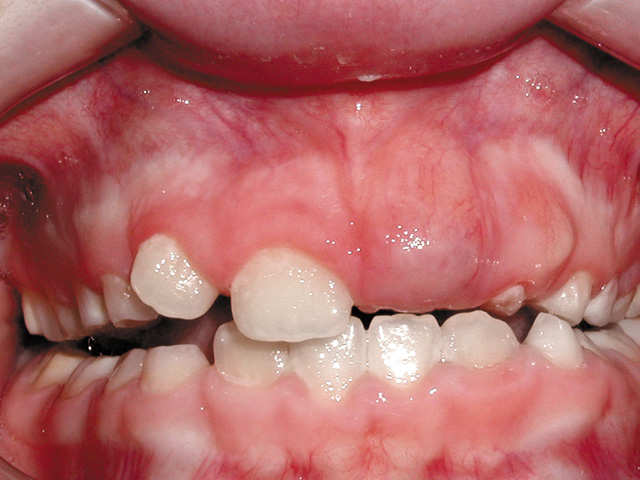 Smile Gallery - Dr. Michael Williamson