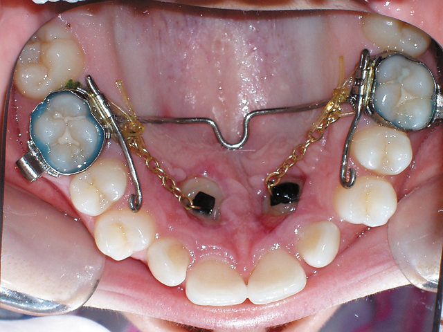 Smile Gallery - Dr. Michael Williamson